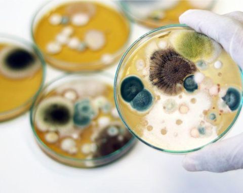 Indicators That Your Home May Be Affected by Mold 